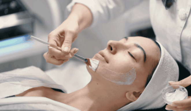 Chemical Peels